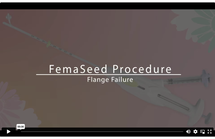 FemaSeed Procedure video showing a flange failure