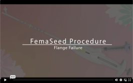 FemaSeed Procedure video showing a flange failure