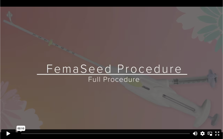 FemaSeed Procedure video showing the full procedure